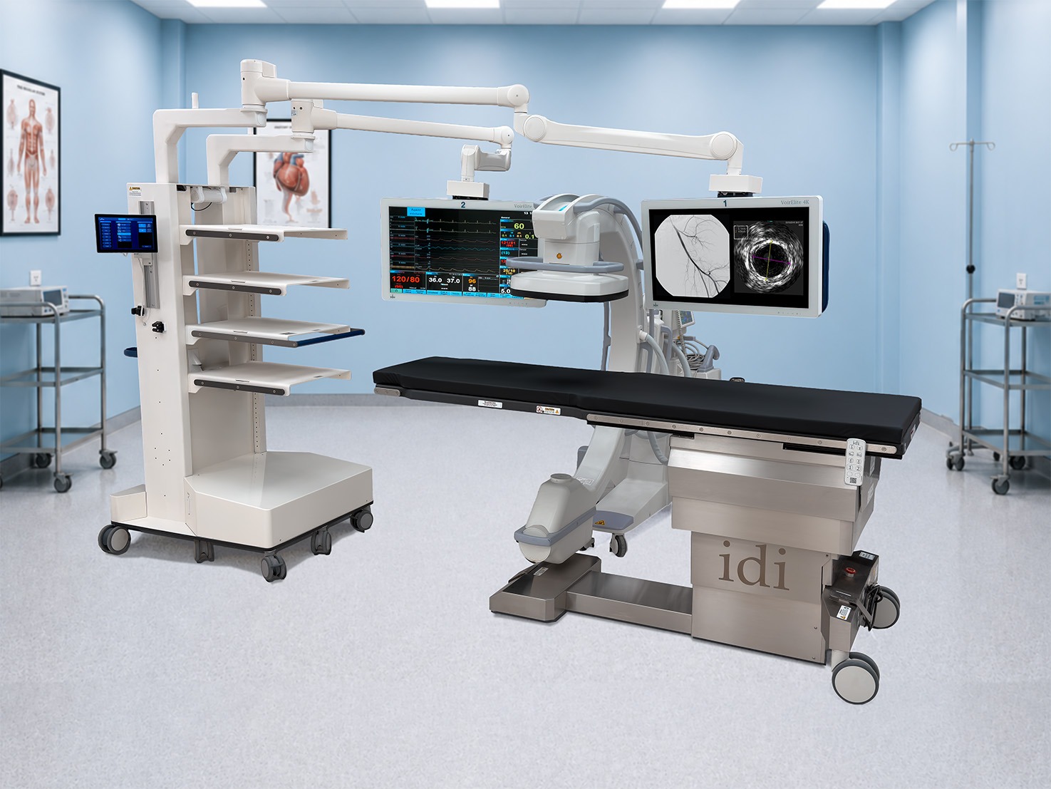 ilex DUO endovascular